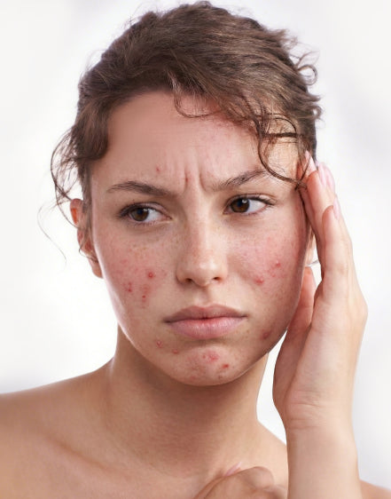 Aktivkohlefilter-Hyeton™  Filterduschkopf (6 Monate)